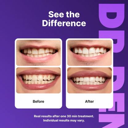 DR.DENT Purple Teeth Whitening Strips – Peroxide-Free, Non-Sensitive, PAP Formula | 7 or 21 Sessions
